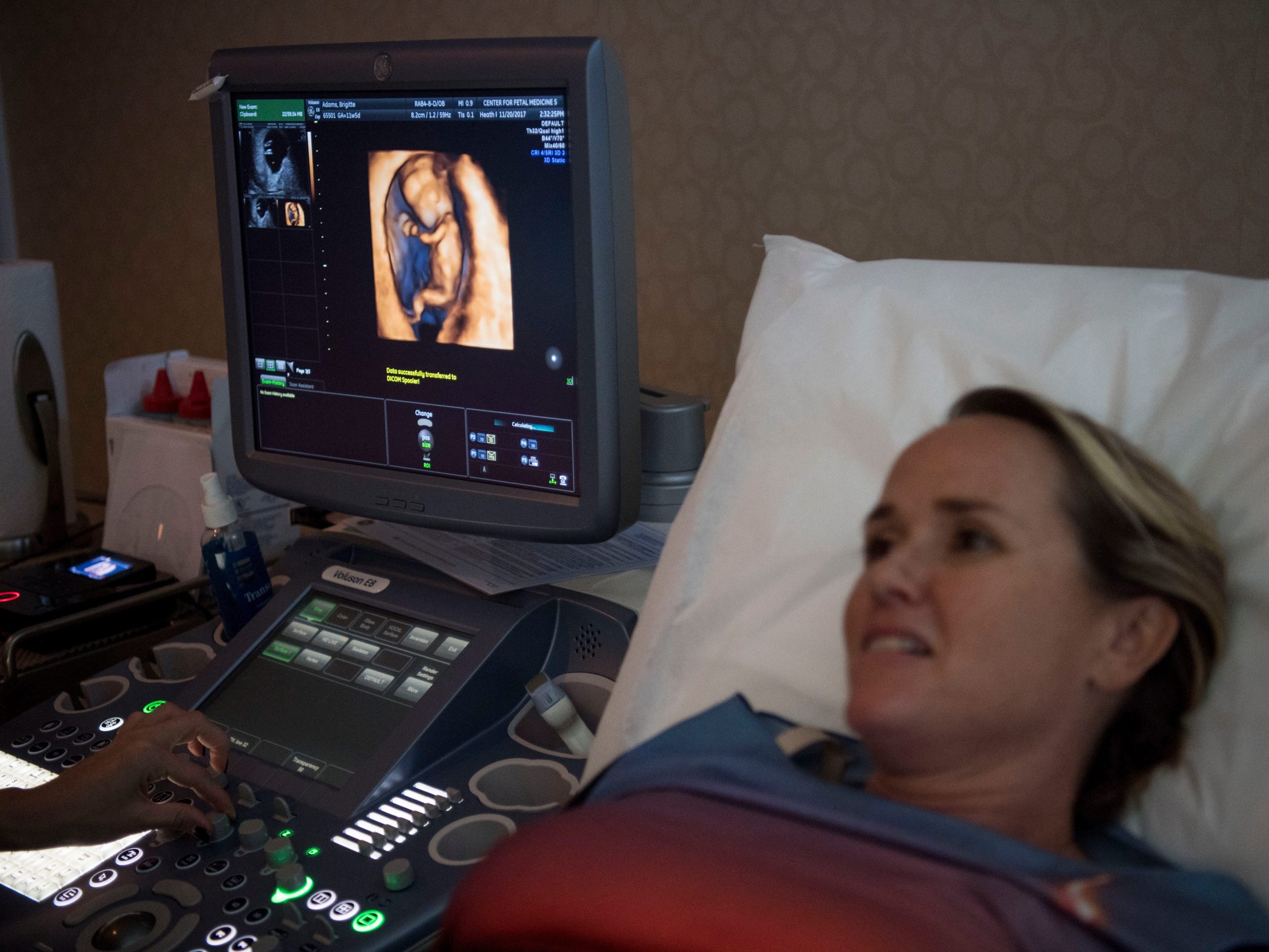 Brigitte Adams looks at an ultrasound of her pregnancy at the Center for Fetal Medicine in Los Angeles, CA.