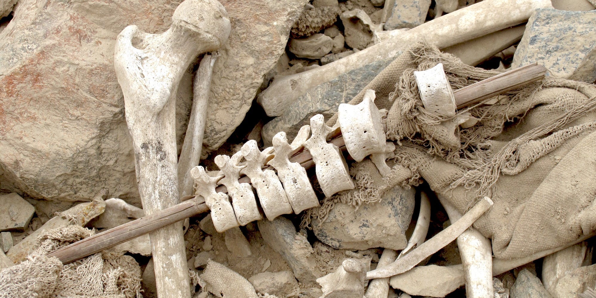 Vertebrae-on-post are seen in the field among other bones.