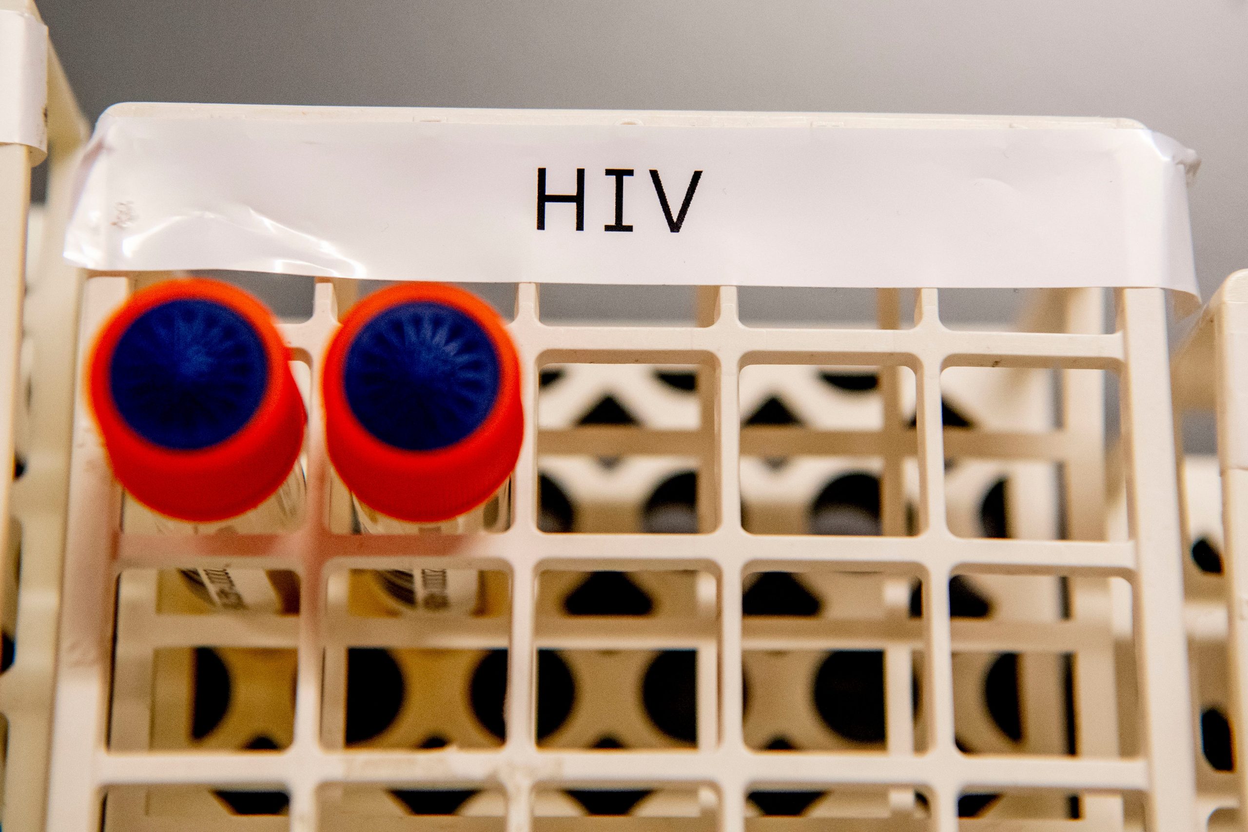 HIV-positive patients in the Netherlands