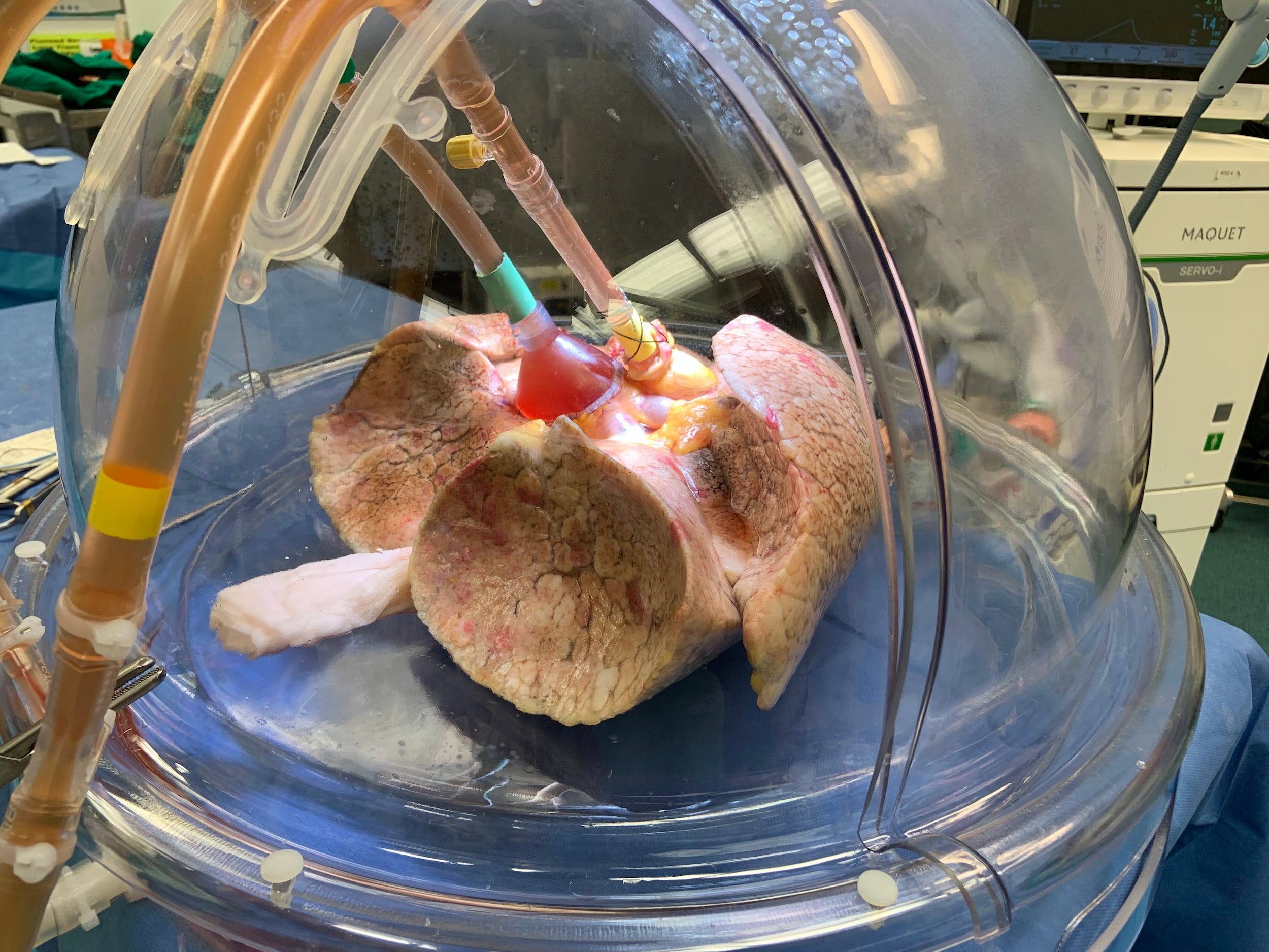dry pink lung inside glass dome with suction cups and tubes attached to it