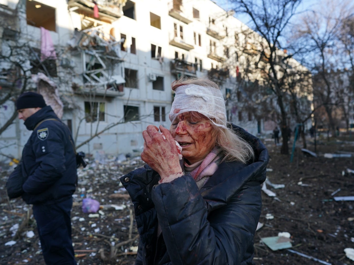 A wounded woman is seen after an airstrike damaged an apartment complex in city of Chuhuiv, Kharkiv Oblast, Ukraine on February 24, 2022.