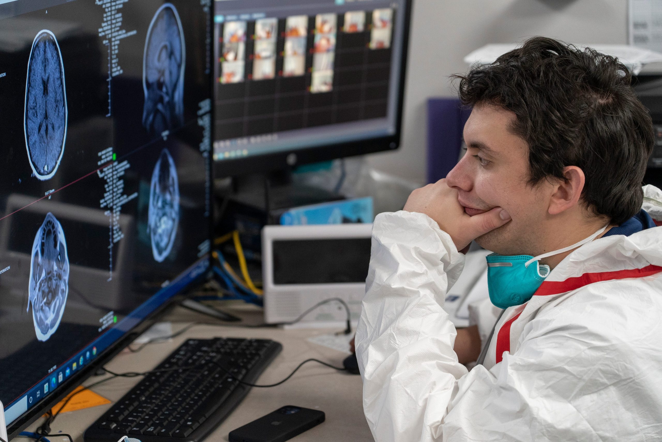 brain scan COVID