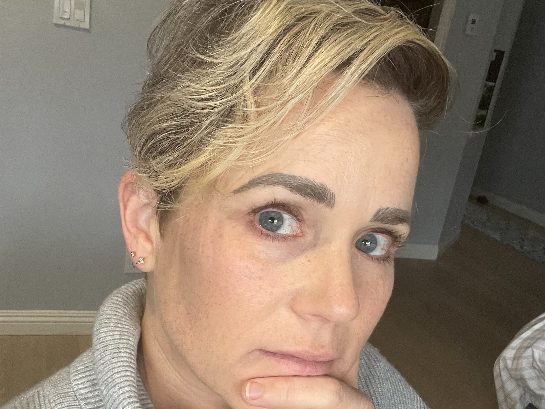 I can't stop pulling out my own hair. I've tried to hide my bald spots with hats and wigs, but nothing helps with my shame. I can't stop pulling out my own hair. I've tried to hide my bald spots with hats and wigs, but nothing helps with my shame.