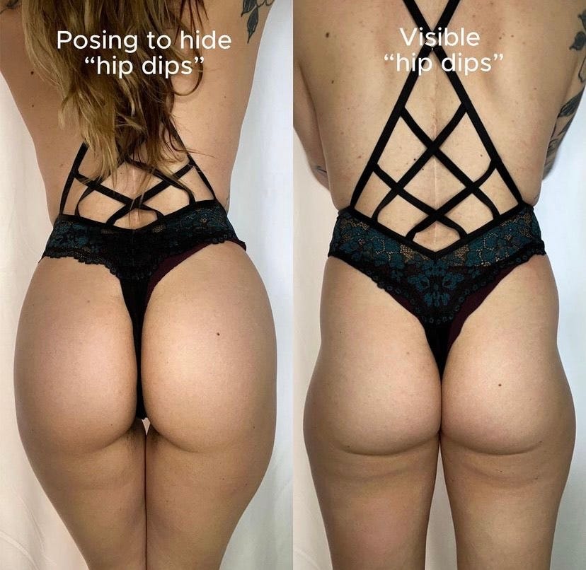 Sara Puhto posing in a way to conceal hip dips and what they actually look like.